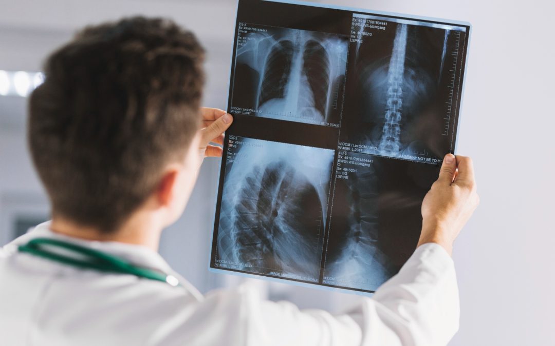When Should You Get an X-Ray in Morehead City? 5 Signs You Shouldn’t Ignore